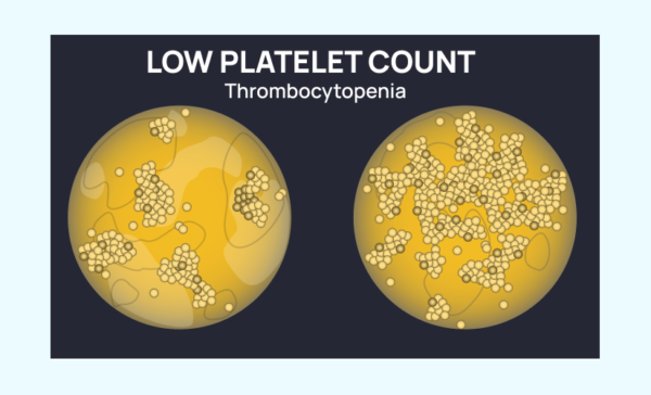 Platelet Count